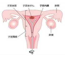 子宮の図2