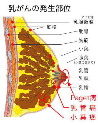 乳がんの発生部位